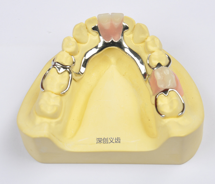 钴铬支架+排牙