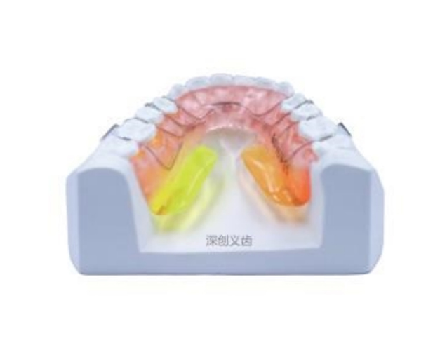 Tongue lifting device